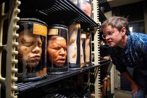 Fascinación y controversia en la historia médica del Mütter Museum - Ciencia - ABC Color