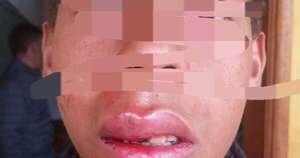 La Nación / Agreden a adolescente en la escuela y su hermana denuncia atención hospitalaria tardía