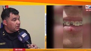 ¡Es posible! Dejaron sin diente a poli durante enfrentamiento