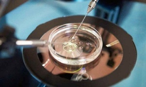Médicos Católicos se oponen al financiamiento estatal de la fecundación in vitro - OviedoPress