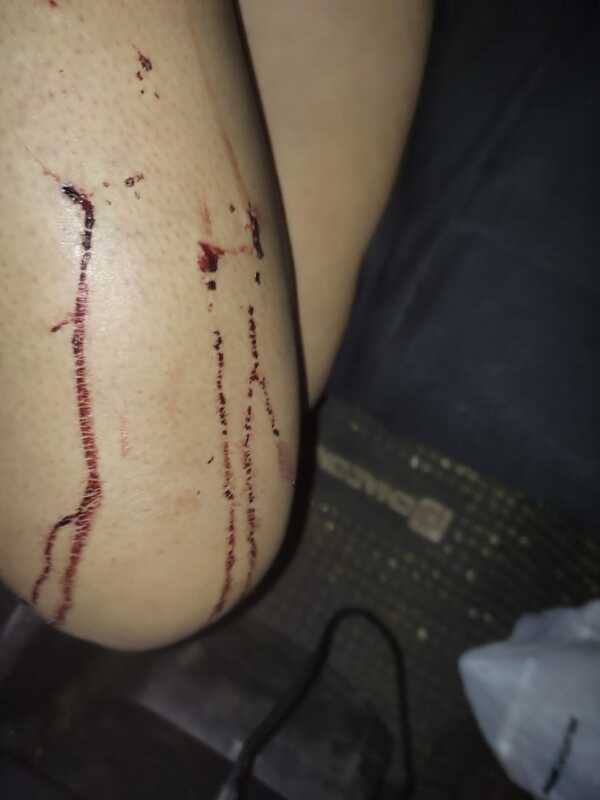 Popular / Doña pecheó para su hijo enfermo y fue acuchillada