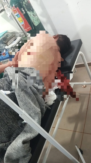 Hombre resultó herido con arma blanca tras discusión en Juan León Mallorquín - Info Alto Parana