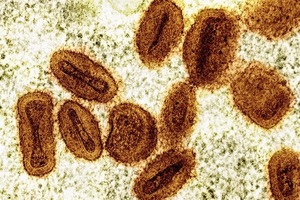 Brote de viruela símica en África ya no es una emergencia de salud global
