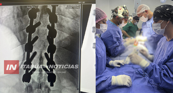 HOSPITAL GENERAL REALIZA CON ÉXITO UNA COMPLEJA CIRUGÍA DE COLUMNA