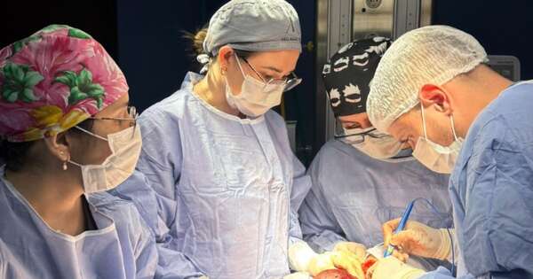 Diario HOY | Bocio multinodular: extrajeron enorme tumor a una paciente