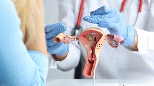 IPS realizará cirugías gratuitas de ligadura de trompas de falopio