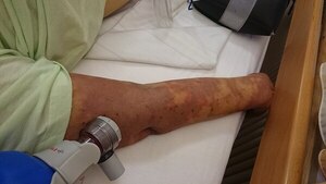 El pasado sábado se recordó el Día Mundial de la Sepsis