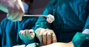 La Nación / Histórico: realizan con éxito la primera neurocirugía en el Hospital de San Pedro