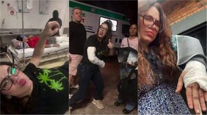 Popular / (VIDEO) Clara Franco pasó por el quirófano y dijo: "Muñeca atornillada"