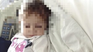 Beba de 1 año 8 meses pelea por su vida a causa de la leishmaniasis