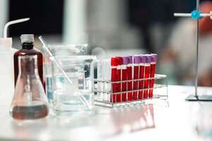 El futuro del Alzheimer: un test sanguíneo redefine la detección y el tratamiento - Ciencia - ABC Color
