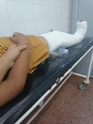 Niño fue agredido por un compañero de escuela y sufrió una fractura de rodilla