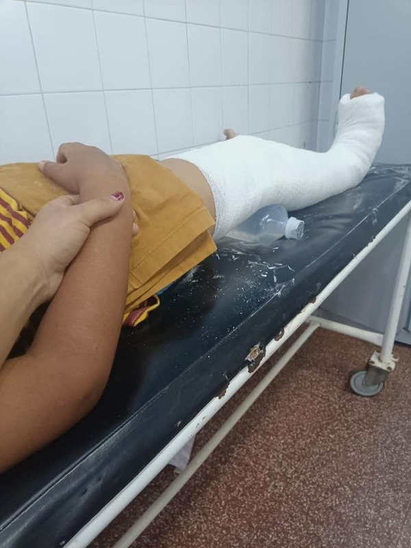 Niño fue agredido por un compañero de escuela y sufrió una fractura de rodilla