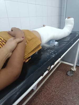 Popular / Bullying y racismo: ¡Compañero le garroteó ha omopë su rodilla!