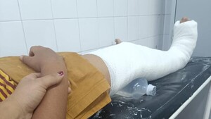 Un niño sufrió brutal patada durante partido de fútbol de la escuela