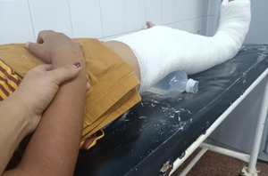 CDE: Denuncian bullying y racismo en escuela pública tras lesión grave de estudiante - ADN Digital