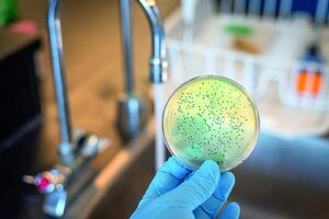 Bacterias NDM ponen en jaque el uso de antibióticos en EE. UU
