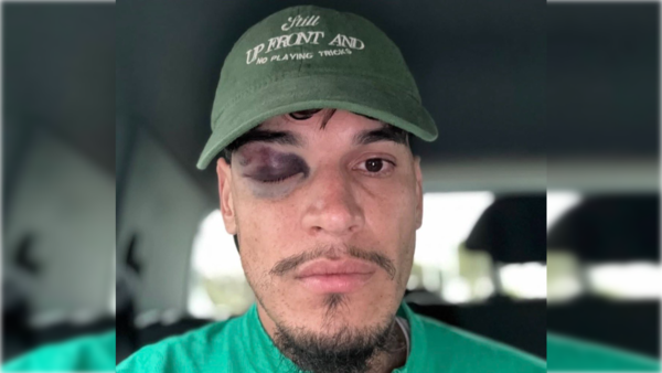Preocupación en Palmeiras por Gustavo Gómez