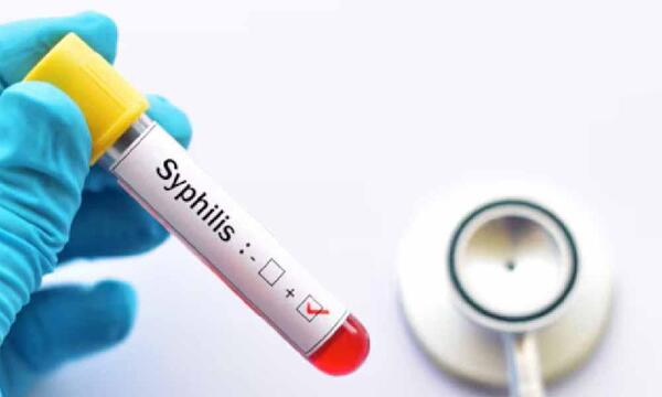 Se disparan casos de sífilis en jóvenes: instan al testeo anual – Prensa 5