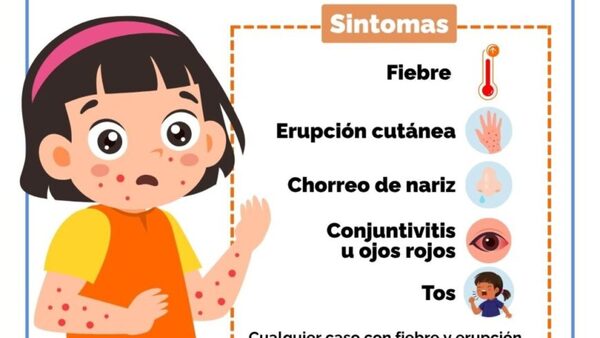 Se confirma un caso de sarampión en Central