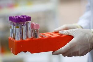 Esto indica el IPS sobre el laboratorio y toma de muestras en Villeta - Nacionales - ABC Color