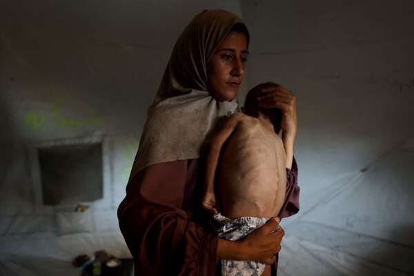 Niños muertos por hambre en Gaza llegan a los 150 - Mundo - ABC Color