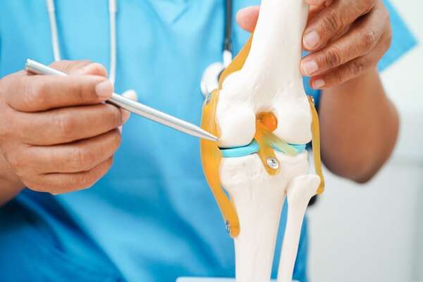 Diferencias entre artritis y artrosis: lo que debés saber para cuidar tus articulaciones - Estilo de vida - ABC Color
