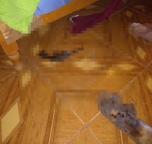 Intento de feminicidio en General Aquino deja a mujer gravemente herida y al agresor muerto - ADN Digital