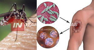 LA VII REGIÓN SANITARIA REFUERZA LA VIGILANCIA CONTRA LA LEISHMANIASIS