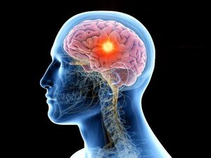 Día Mundial de la Parálisis Cerebral: estrategias para mejorar autonomía y calidad de vida