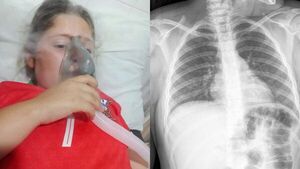 Piden ayuda para niña con epilepsia y problemas pulmonares