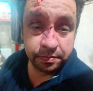 Intento de robo en un bus de Capiatá: dos personas resultan heridas con una botella rota - Policiales - ABC Color