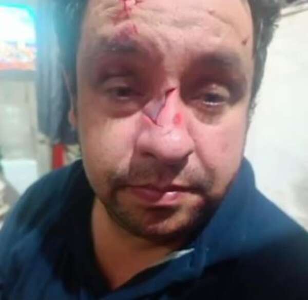 Intento de robo en un bus de Capiatá: dos personas resultan heridas con una botella rota   - Policiales - ABC Color
