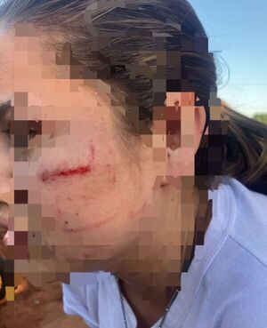 Denuncian agresión a una alumna dentro del Colegio Alejo García de Horqueta - Concepción al Día