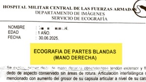 Le operaron la mano equivocada a una beba