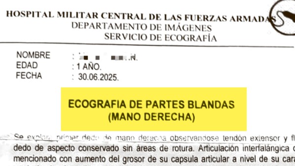 Le operaron la mano equivocada a una beba