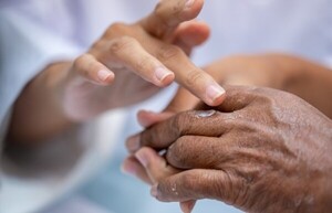 Paraguay diagnostica anualmente entre 250 y 300 casos de lepra