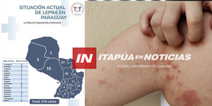 LEPRA: NOTIFICACIONES DE CASOS SE MANTIENEN DENTRO DE LO ESPERADO