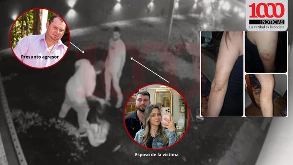 Abaí: Mujer fue brutalmente golpeada y amenazada de muerte