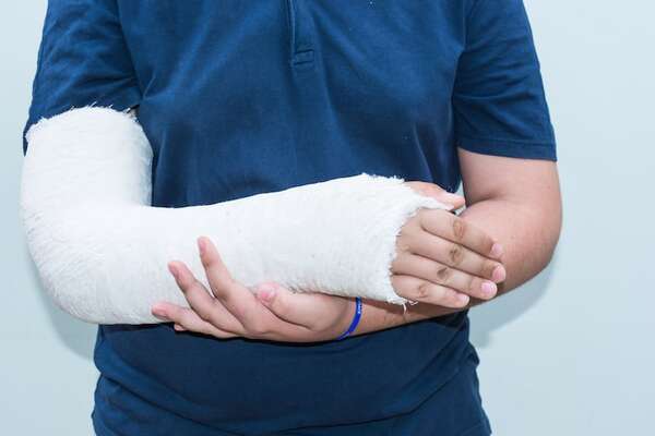 Hong Kong desarrolla nanocemento óseo para tratamiento de fracturas y reparación rápida - Ciencia - ABC Color