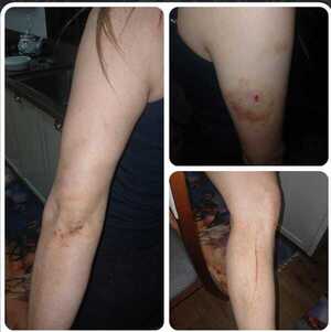 Popular / ¡Imputan hapóre a violento rapái que surtió a golpes a la esposa de su primo