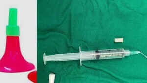 Nena de 3 años se tragó la corneta de la piñata y terminó en el INERAM