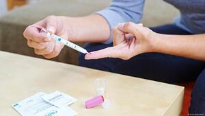 Descubren en Alemania eficaz anticuerpo contra el VIH
