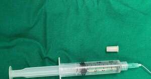 Diario HOY | Niña de 3 años “se convirtió en trompeta” al tragar un silbato que recogió de una piñata