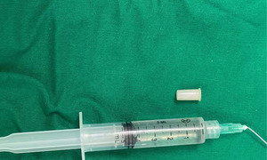 “Cuando se reía, silbaba”: insólito caso de una niña atendida en el Ineram - OviedoPress