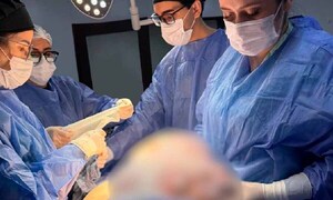Extirpan tumor ovárico de 11 kilogramos en Pedro Juan Caballero – Prensa 5