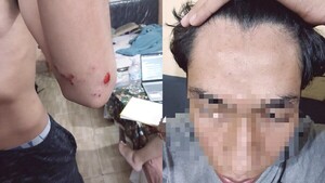 Agredió a un alumno porque su exnovia “macaneó” con él cuando se dejaron