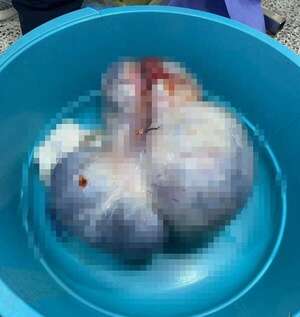 Extirpan tumor gigante de ovario en Hospital Regional de Pedro Juan Caballero - Nacionales - ABC Color