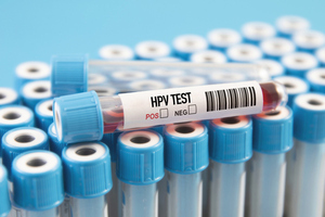 Más del 80% de la población sexualmente activa podría infectarse con VPH en algún momento