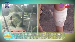 Perro agresivo genera alarma en un barrio de Luque tras reiterados ataques a vecinos